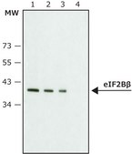 Anti-eIF2Bβ (N-terminal) antibody produced in rabbit ~1.0 mg/mL, affinity isolated antibody, buffered aqueous solution