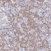 Anti-ARFGAP3 antibody produced in rabbit Prestige Antibodies® Powered by Atlas Antibodies, affinity isolated antibody, buffered aqueous glycerol solution