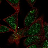 Anti-TMEM86A antibody produced in rabbit Prestige Antibodies® Powered by Atlas Antibodies, affinity isolated antibody, buffered aqueous glycerol solution