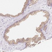 Anti-SOAT1 antibody produced in rabbit Prestige Antibodies® Powered by Atlas Antibodies, affinity isolated antibody, buffered aqueous glycerol solution