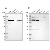 Anti-GARS antibody produced in rabbit Prestige Antibodies® Powered by Atlas Antibodies, affinity isolated antibody, buffered aqueous glycerol solution