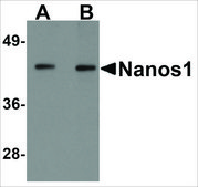Anti-Nanos1 (ab2) antibody produced in rabbit affinity isolated antibody, buffered aqueous solution