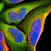 Anti-AHSA1 antibody produced in rabbit Prestige Antibodies® Powered by Atlas Antibodies, affinity isolated antibody, buffered aqueous glycerol solution