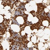 Anti-C1R antibody produced in rabbit Prestige Antibodies® Powered by Atlas Antibodies, affinity isolated antibody, buffered aqueous glycerol solution