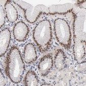 Anti-FOSL2 antibody produced in rabbit Prestige Antibodies® Powered by Atlas Antibodies, affinity isolated antibody, buffered aqueous glycerol solution