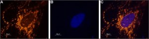 Anti-Sodium Channel, Brain Type I (α subunit) antibody produced in rabbit affinity isolated antibody, lyophilized powder