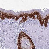 Anti-KRT5 antibody produced in rabbit Prestige Antibodies® Powered by Atlas Antibodies, affinity isolated antibody, buffered aqueous glycerol solution