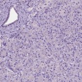 Anti-GPR37L1 antibody produced in rabbit Prestige Antibodies® Powered by Atlas Antibodies, affinity isolated antibody, buffered aqueous glycerol solution