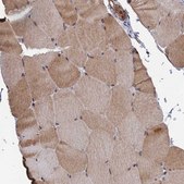 Anti-GTF2IRD1 antibody produced in rabbit Prestige Antibodies® Powered by Atlas Antibodies, affinity isolated antibody, buffered aqueous glycerol solution