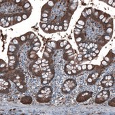 Anti-ALDH1A1 antibody produced in rabbit Prestige Antibodies® Powered by Atlas Antibodies, affinity isolated antibody, buffered aqueous glycerol solution