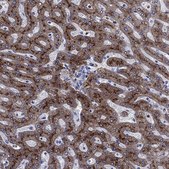 Anti-TFR2 antibody produced in rabbit Prestige Antibodies® Powered by Atlas Antibodies, affinity isolated antibody, buffered aqueous glycerol solution