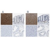 Anti-MAPRE2 antibody produced in rabbit Prestige Antibodies® Powered by Atlas Antibodies, affinity isolated antibody, buffered aqueous glycerol solution