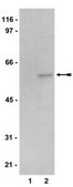 AMPK Pathway Explorer Antibody MiniPack 1 mg/mL, Upstate®