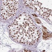 Anti-EED antibody produced in rabbit Prestige Antibodies® Powered by Atlas Antibodies, affinity isolated antibody, buffered aqueous glycerol solution
