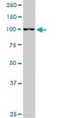 Monoclonal Anti-RABGAP1L antibody produced in mouse clone 2D3, purified immunoglobulin, buffered aqueous solution