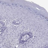 Anti-ACTL7A antibody produced in rabbit Prestige Antibodies® Powered by Atlas Antibodies, affinity isolated antibody, buffered aqueous glycerol solution, Ab1