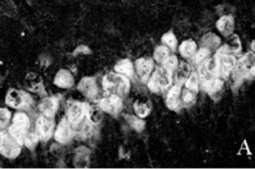 Anti-NeuN Antibody, clone A60 clone A60, Chemicon®, from mouse