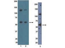 Anti-ALK7 Antibody Upstate®, from rabbit