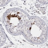 Anti-FNDC8 antibody produced in rabbit Prestige Antibodies® Powered by Atlas Antibodies, affinity isolated antibody, buffered aqueous glycerol solution