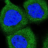 Anti-PPP6R1 antibody produced in rabbit Prestige Antibodies® Powered by Atlas Antibodies, affinity isolated antibody, buffered aqueous glycerol solution
