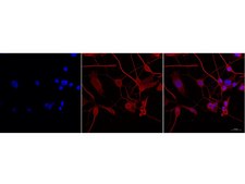 Milli-Mark® Pan Neuronal Marker Milli-Mark Pan Neuronal Marker is an antibody targeting the Pan Neuronal Marker protein, validated for use in ICC, IHC, IF &amp; IHC.