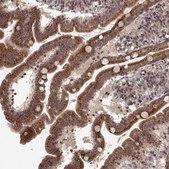 Anti-TRMU antibody produced in rabbit Prestige Antibodies® Powered by Atlas Antibodies, affinity isolated antibody