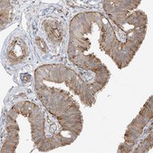 Anti-DCDC2 antibody produced in rabbit Prestige Antibodies® Powered by Atlas Antibodies, affinity isolated antibody, buffered aqueous glycerol solution