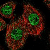Anti-ZNF449 antibody produced in rabbit Prestige Antibodies® Powered by Atlas Antibodies, affinity isolated antibody, buffered aqueous glycerol solution