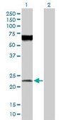 Anti-POFUT1 antibody produced in rabbit purified immunoglobulin, buffered aqueous solution