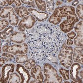 Anti-BNIP3 antibody produced in rabbit Prestige Antibodies® Powered by Atlas Antibodies, affinity isolated antibody, buffered aqueous glycerol solution