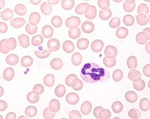 Hemacolor® Rapid staining of blood smear Solution 1: fixing solution