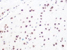 Anti-DDB1 antibody produced in rabbit