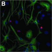 Monoclonal Anti-MAP2 antibody produced in mouse ascites fluid, clone HM-2