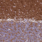 Anti-NCAM1 antibody produced in rabbit Prestige Antibodies® Powered by Atlas Antibodies, affinity isolated antibody, buffered aqueous glycerol solution