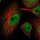 Anti-HUWE1 antibody produced in rabbit Prestige Antibodies® Powered by Atlas Antibodies, affinity isolated antibody, buffered aqueous glycerol solution