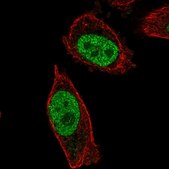 Anti-ABHD16B antibody produced in rabbit Prestige Antibodies® Powered by Atlas Antibodies, affinity isolated antibody, buffered aqueous glycerol solution