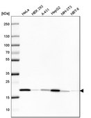 Monoclonal Anti-PPIB antibody produced in mouse Prestige Antibodies® Powered by Atlas Antibodies, clone CL3915, purified immunoglobulin, buffered aqueous glycerol solution