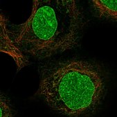 Anti-ZDHHC16 antibody produced in rabbit Prestige Antibodies® Powered by Atlas Antibodies, affinity isolated antibody
