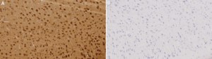 Anti-Protein Gene Product 9.5 Antibody serum, Chemicon®