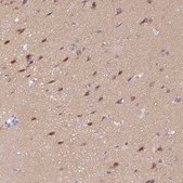 Anti-CTNND2 antibody produced in rabbit Prestige Antibodies® Powered by Atlas Antibodies, affinity isolated antibody, buffered aqueous glycerol solution