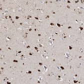 Anti-SLC10A4 antibody produced in rabbit Prestige Antibodies® Powered by Atlas Antibodies, affinity isolated antibody, buffered aqueous glycerol solution