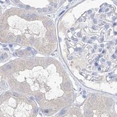 Anti-FRS3 antibody produced in rabbit Prestige Antibodies® Powered by Atlas Antibodies, affinity isolated antibody, buffered aqueous glycerol solution, ab2