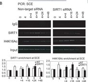 Anti-acetyl-Histone H4 (Lys16) Antibody Upstate®, from rabbit