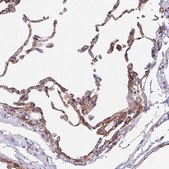 Anti-LIMCH1 antibody produced in rabbit Prestige Antibodies® Powered by Atlas Antibodies, affinity isolated antibody, buffered aqueous glycerol solution