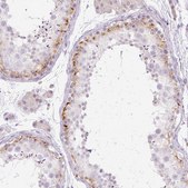 Anti-GRID2 antibody produced in rabbit Prestige Antibodies® Powered by Atlas Antibodies, affinity isolated antibody, buffered aqueous glycerol solution