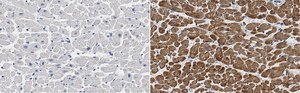 Anti-Cardiac Troponin I Antibody, clone 1F23, ZooMAb® Rabbit Monoclonal recombinant, expressed in HEK 293 cells
