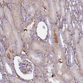 Anti-CRHBP antibody produced in rabbit Prestige Antibodies® Powered by Atlas Antibodies, affinity isolated antibody, buffered aqueous glycerol solution