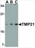 Anti-TMP21 (ab2) antibody produced in rabbit affinity isolated antibody, buffered aqueous solution