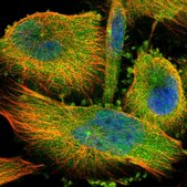 Anti-CCDC57 antibody produced in rabbit Prestige Antibodies® Powered by Atlas Antibodies, affinity isolated antibody, buffered aqueous glycerol solution, Ab4