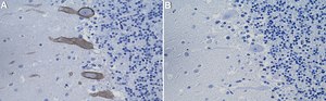 Anti-PKCγ Antibody, clone 2B9 ZooMAb® Rabbit Monoclonal recombinant, expressed in HEK 293 cells